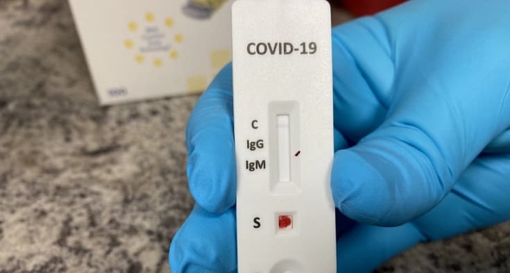 exame teste diagnostico coronavirus