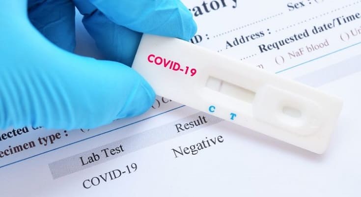 teste rapido coronavirus covid19